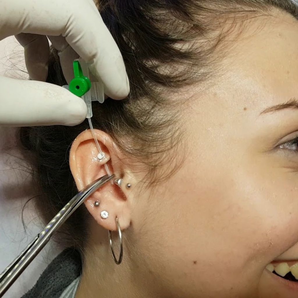 Pain Level and Healing Time of Rook Piercing
